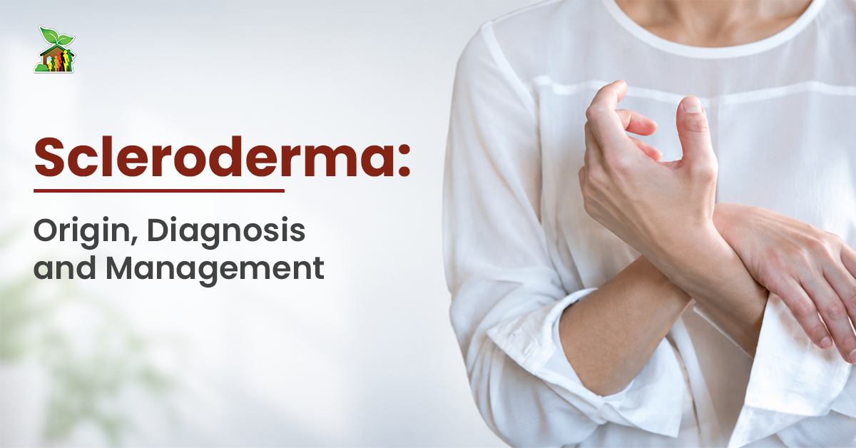 Scleroderma: Origin, Diagnosis and Management