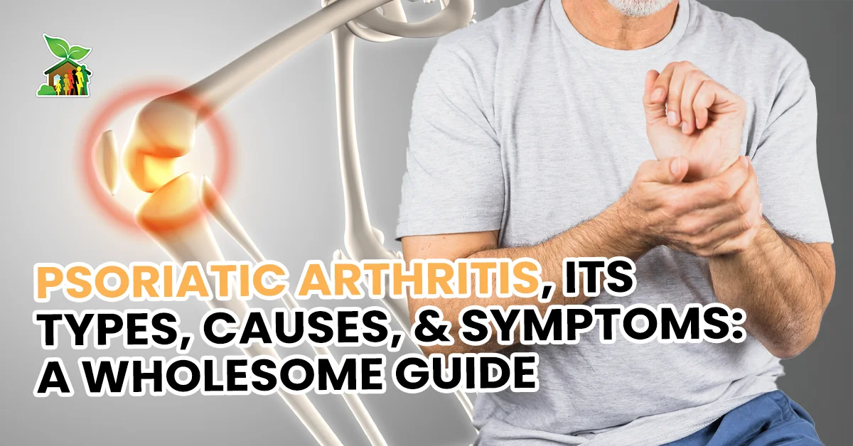 Psoriatic Arthritis, Its Types, Causes, & Symptoms: A Wholesome Guide