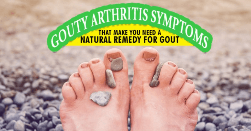 Gouty Arthritis Symptoms That Make You Need A Natural Remedy For Gout