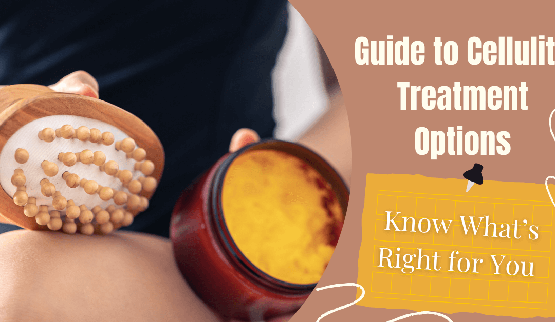 Guide to Cellulite Treatment Options: Know What’s Right for You