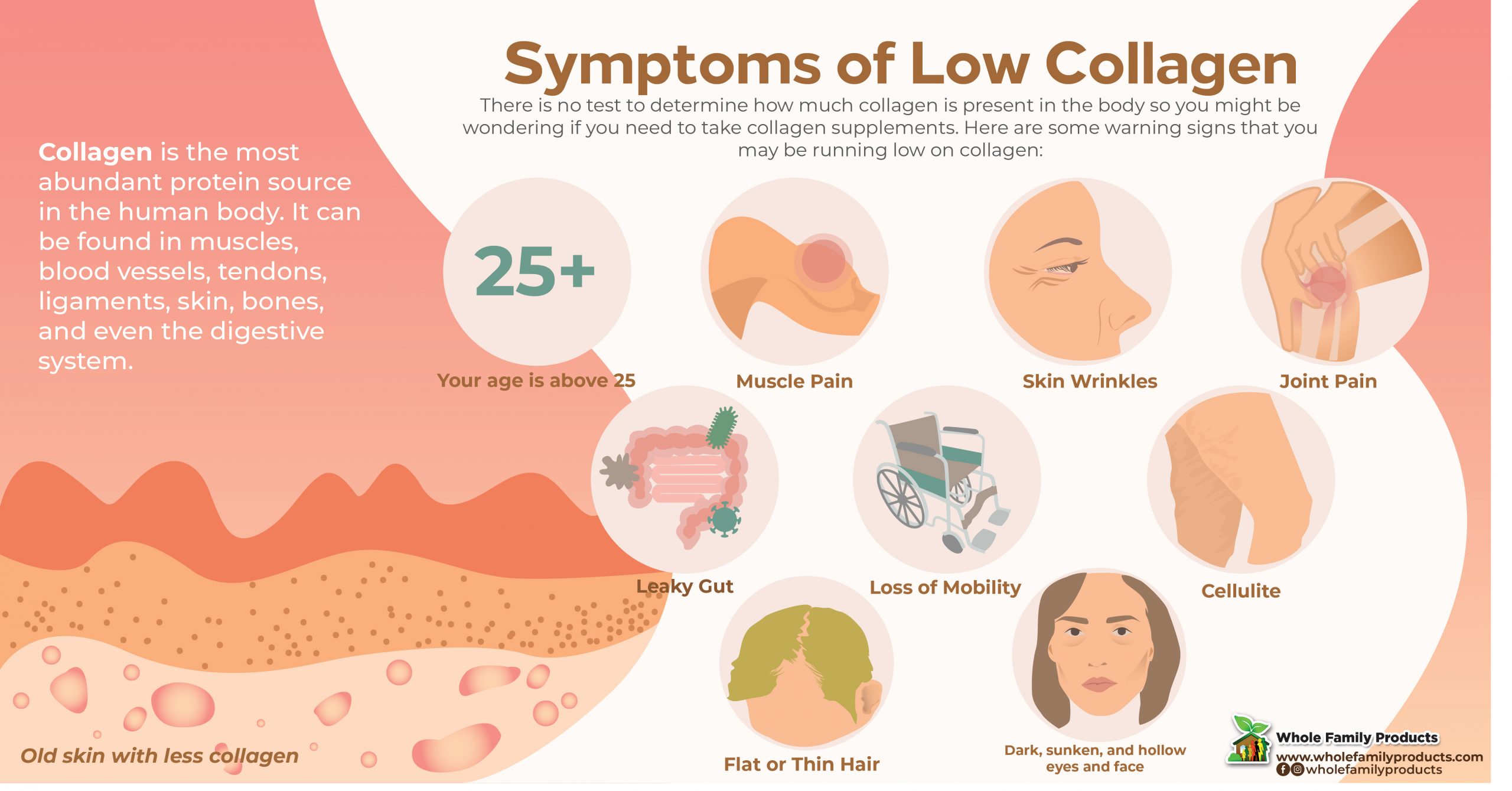 Symptoms of Low Collagen-infographics